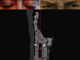 Absence Presence
